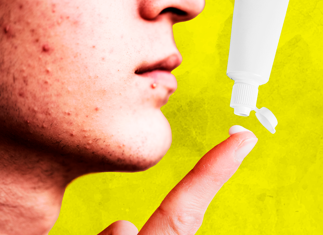 Persona con pasta de dientes en su índice.